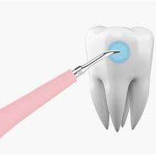 Charger l\'image dans la visionneuse de la galerie, Portable Dental Tartar Remover