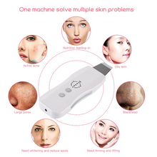 Load image into Gallery viewer, Ultrasonic Vibrating Face Cleansing Machine