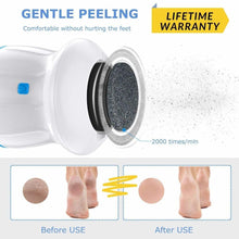 Load image into Gallery viewer, Wireless USB-Rechargeable Electric Callus Remover